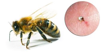 Дар таркиби Hondrostrong дохил пчелиный заҳри, ки ба бењтар нуқтаҳои мубодилаи асъор ба равандҳои дар дур серравѓан бофтаҳои